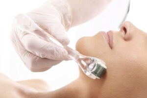 derma roller na zmarszczki i blizny jak szybko i skutecznie 3392247